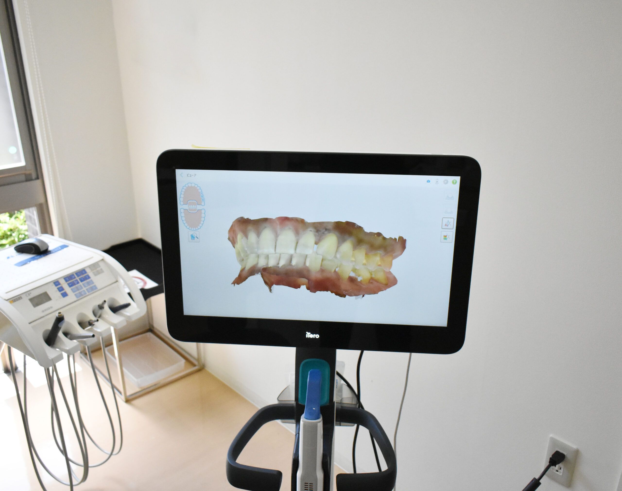 デジタル歯科治療
